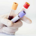 The Power of a Comprehensive Wellness Blood Test