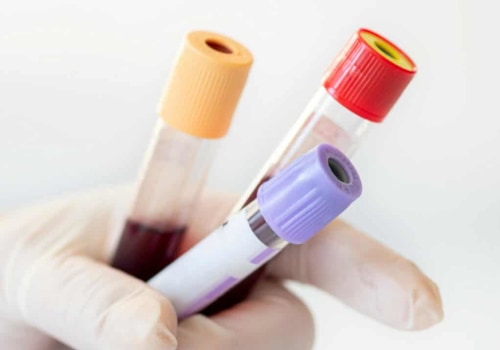 The Power of a Comprehensive Wellness Blood Test